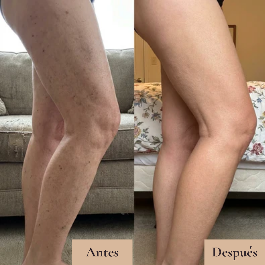 Revitalya Body Coverage
