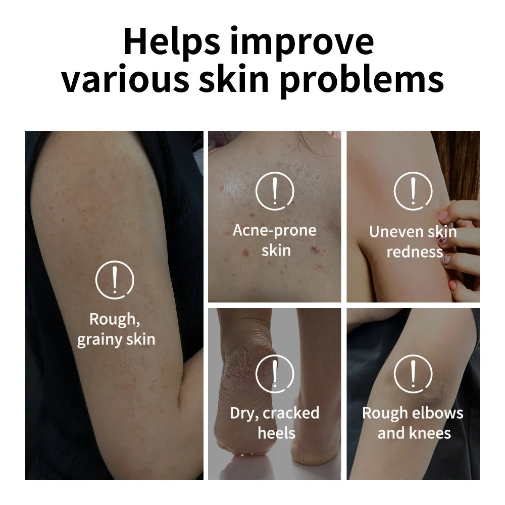Body Effective Exfoliation Stick Glycolic Acid Exfoliating Deep Exfoliation Nourishing Moisture Deep Hydration Skincare