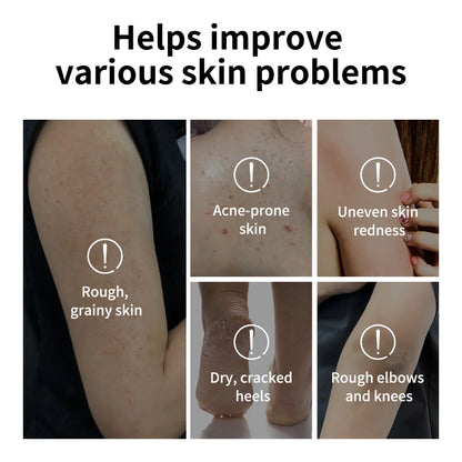 Body Effective Exfoliation Stick Glycolic Acid Exfoliating Deep Exfoliation Nourishing Moisture Deep Hydration Skincare