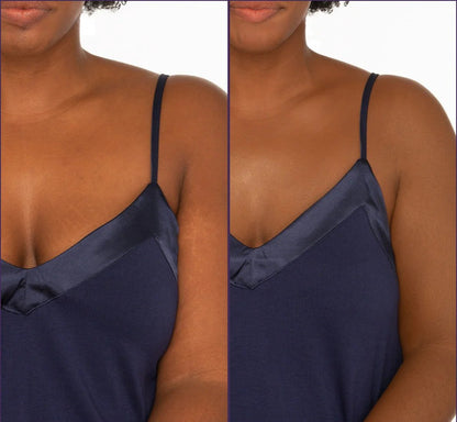 Revitalya Body Coverage